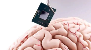 بشريحة دماغية متطورة.. كيف استعاد نولاند هاربو استقلالية حركته بعد سنوات من العجز؟